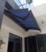 Retractable Awning for House